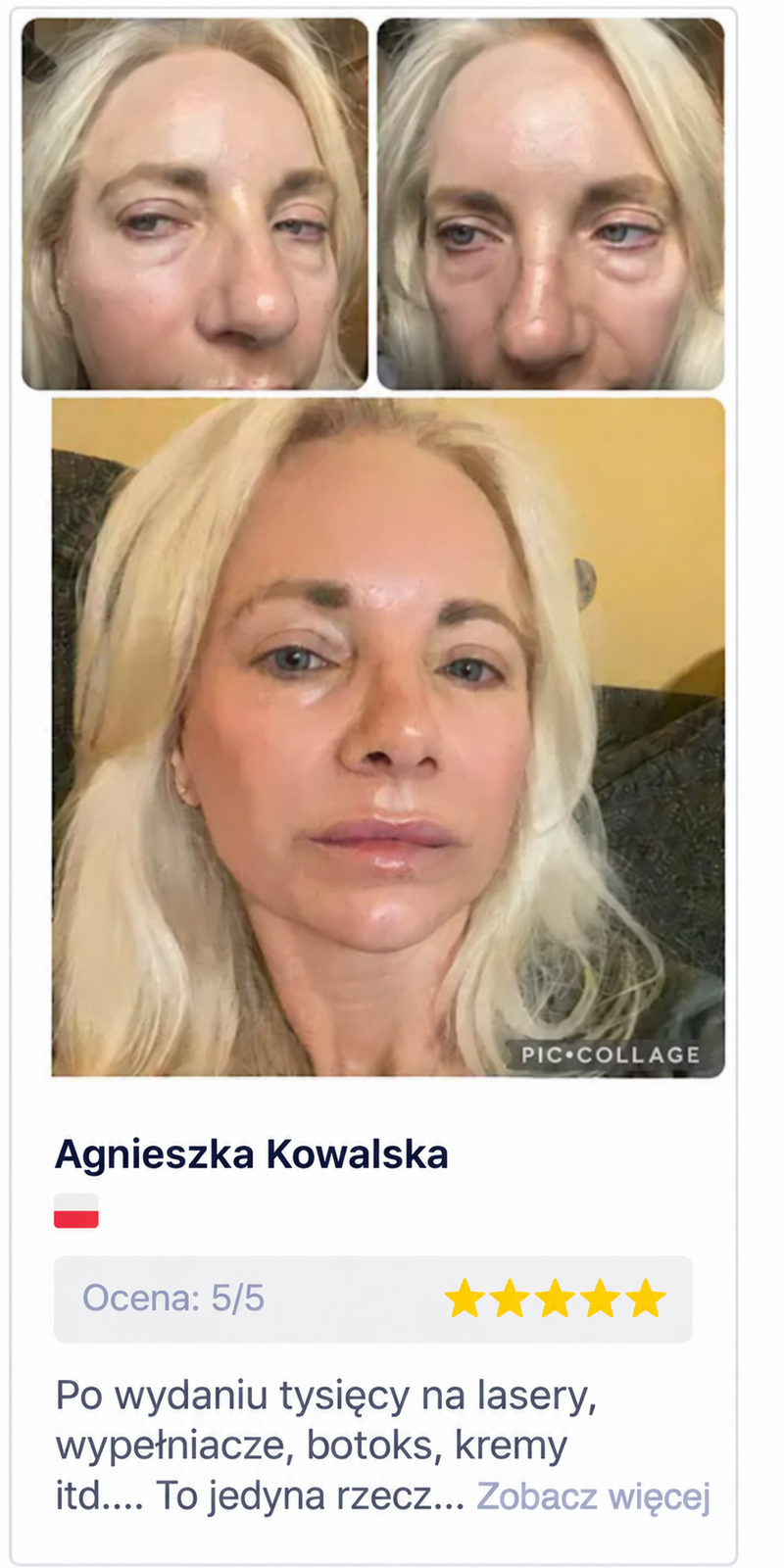 Zdjęcia od klientek